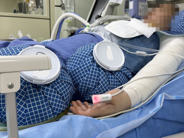 [사진] 중증화상으로 치료 중인 하은이(가명)가 한림대학교한강성심병원에서 치료를 받고 있다