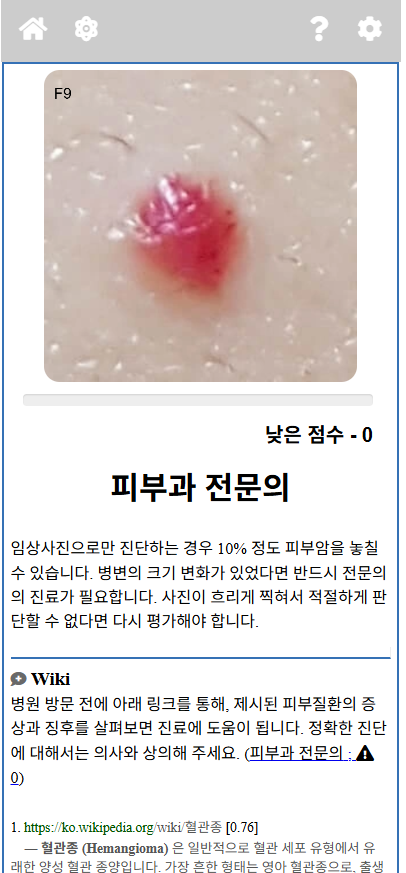 ModelDerm 어플리케이션 사용 화면. 피부 병변 사진을 업로드하면 알고리즘이 질환을 구분한다.