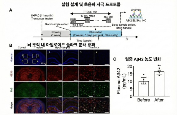 쥐 실험에서 아밀로이드 플라크 제거 및 혈액 배출 확인 (A) 알츠하이머 실험용 쥐에게 2주간(주 5회, 일 30분) 집속 초음파 치료를 시행했다.  (B) 치료를 받지 않은 부위(Control)에 비해 초음파 치료를 받은 부위(Treated)에서 붉은색(아밀로이드 베타 단백질)과 초록색(고밀도 아밀로이드 플라크) 점들이 확연히 줄어든 것을 확인할 수 있다.  (C) 치료 후 혈중 아밀로이드 베타 농도가 치료 전보다 약 66% 증가했다. 이는 분해된 아밀로이드가 혈액을 통해 배출될 가능성이 있음을 의미한다.